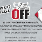 Tattoo Off – Eliminación de Tatuajes en Córdoba | Opiniones y Reseña